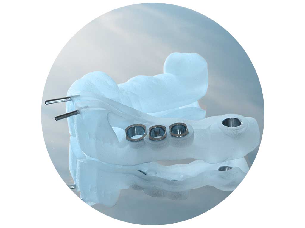SmileTech.fr Laboratoire dentaire spÃ©cialisÃ© dans le domaine numÃ©rique et dans la recherche et dÃ©veloppement liÃ©e Ã  lâ€™impression 3D dans le domaine mÃ©dical en Normandie